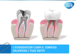 L'endodonzia cura il sorriso salvando i tuoi denti